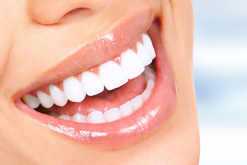 Cosmetic Dentistry in Renton